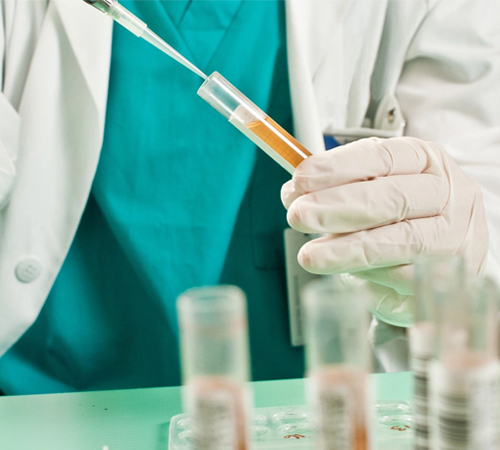 DNA Testing with Urine Collection