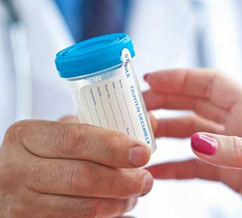 Urine Collection / Pick-Up